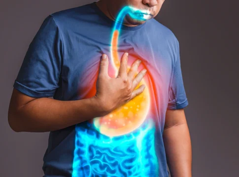 Indigestion